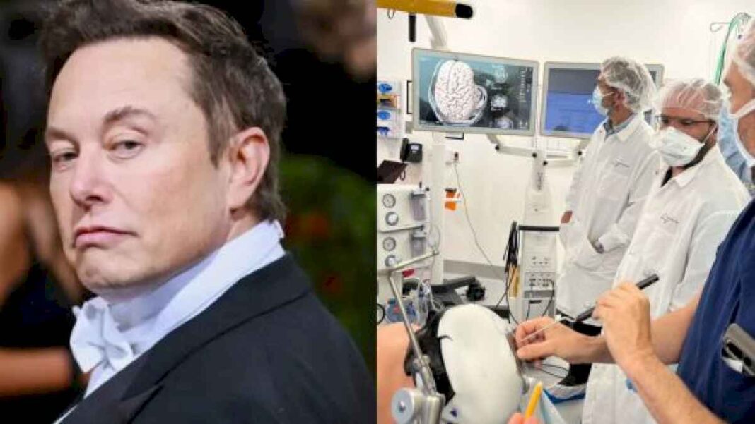 elon-musk-anuncio-que-su-empresa-neuralink-realizo-su-primer-implante-de-un-chip-cerebral-inalambrico-en-un-ser-humano